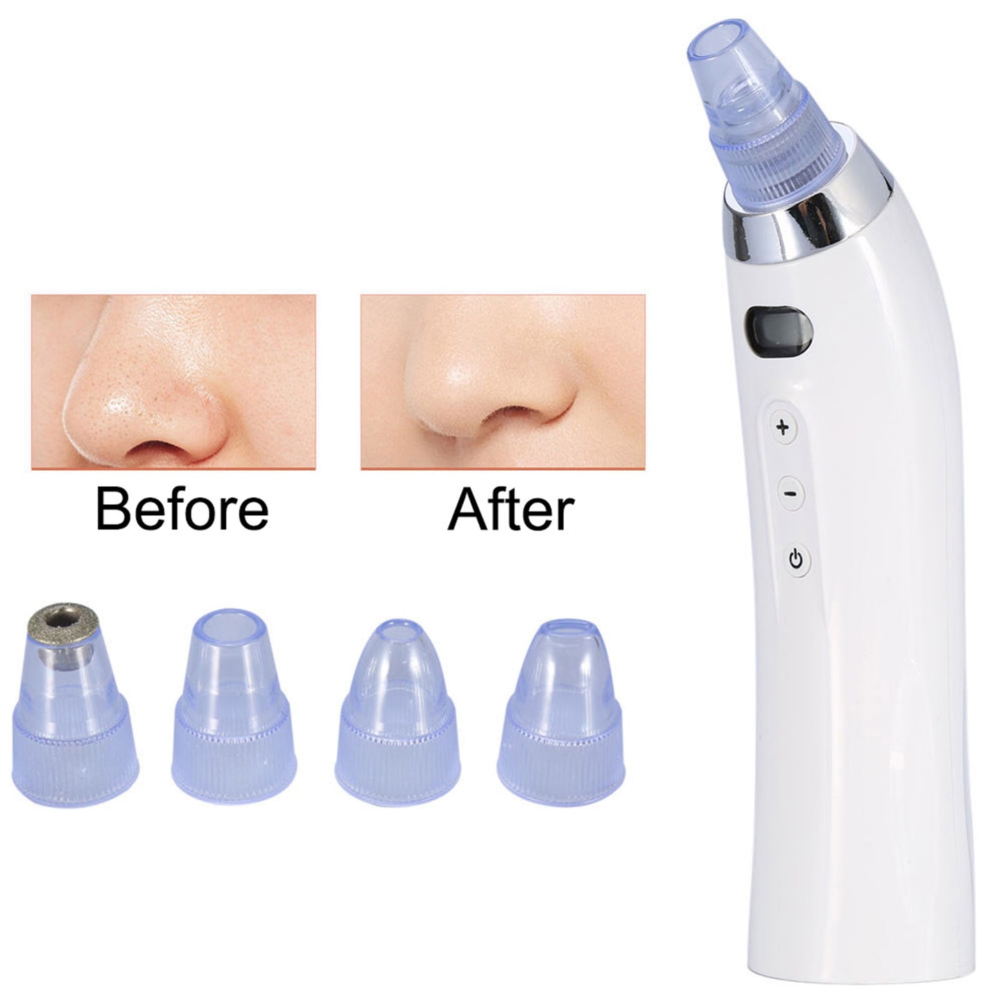 ClearSkin Pro: USB Rechargeable Blackhead Vacuum Extractor for Effortless Pore Cleansing