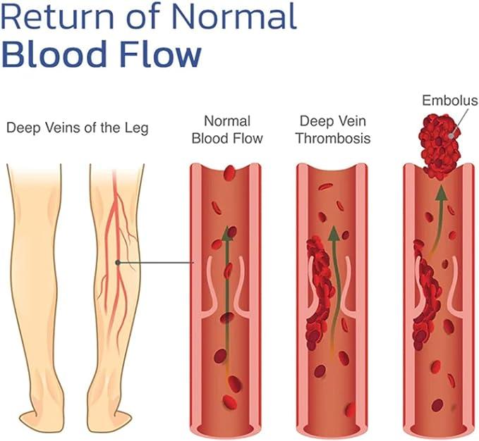 Diagram Showing the Blood Flow in the Legs
